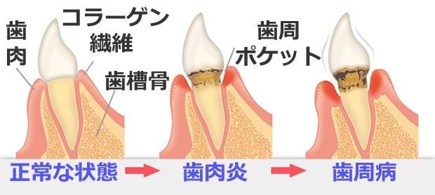 歯周病の恐ろしさ… [トリミングサロンPAWPAW（パウパウ）【ブログ】]